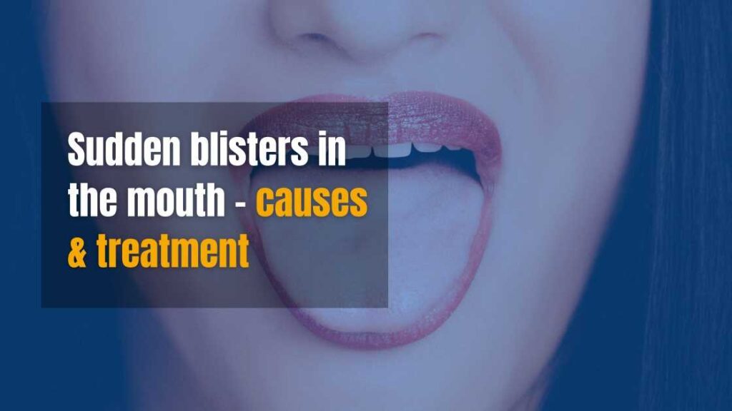 sudden blisters in the mouth
