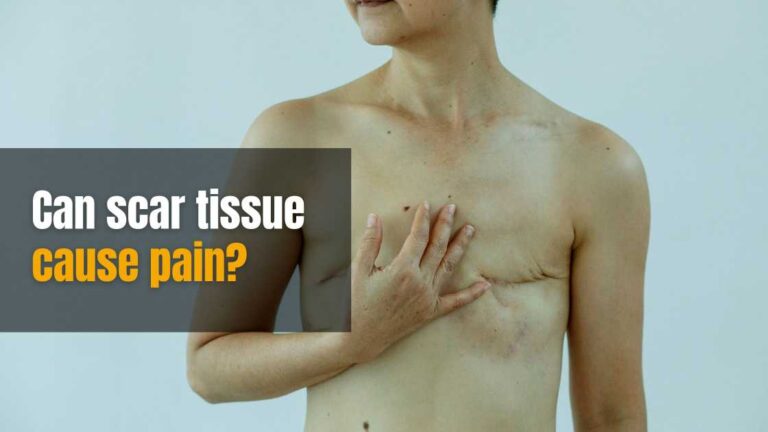Can scar tissue cause pain