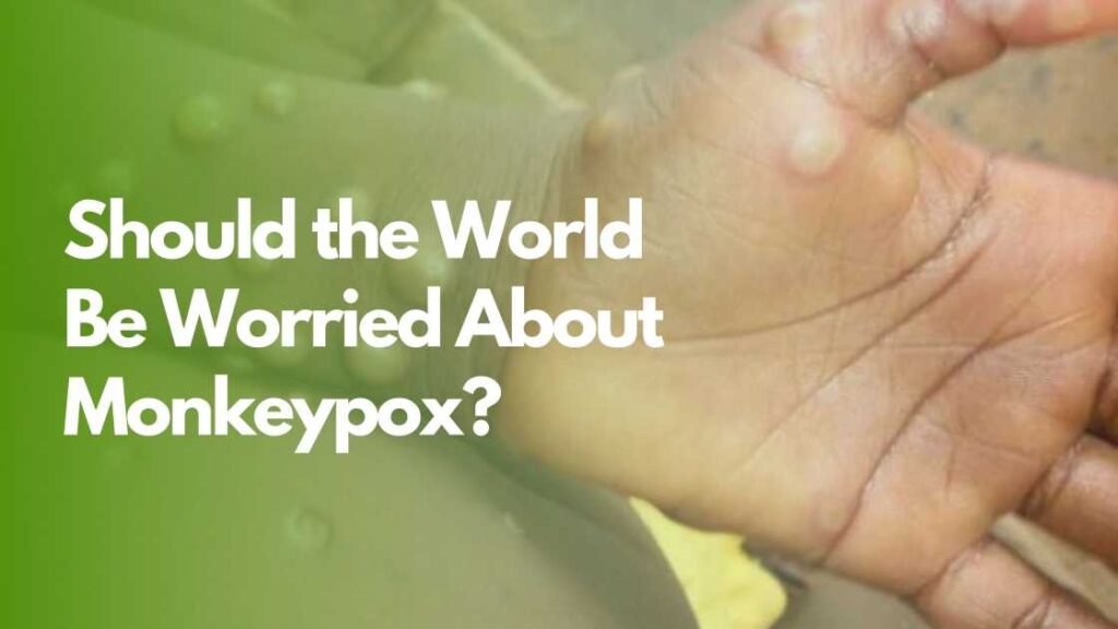 Should the World Be Worried About Monkeypox